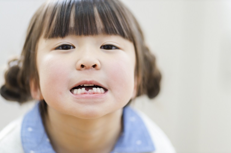 喜連瓜破で小児矯正ならくぼた歯科喜連瓜破院までお越しください